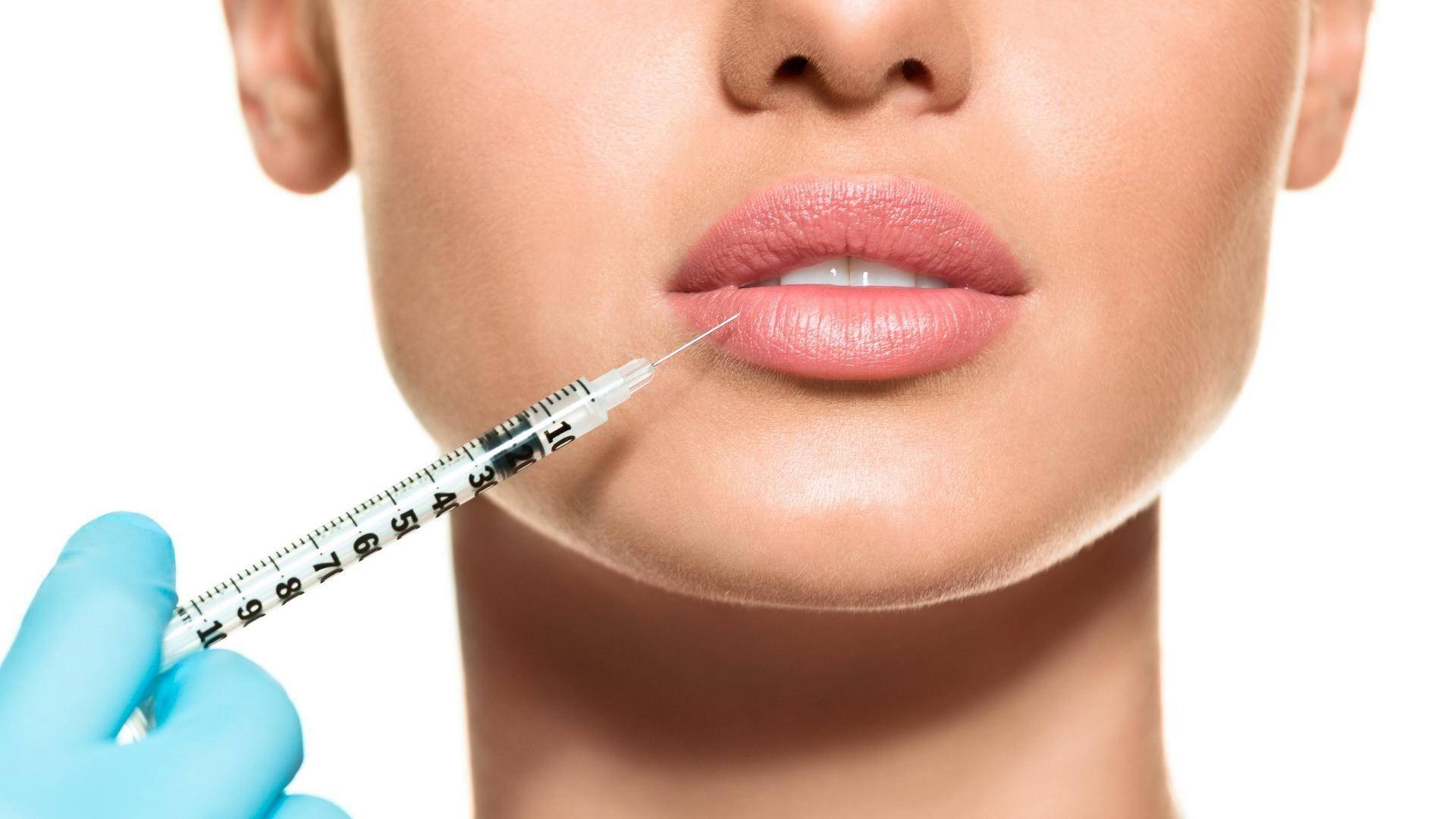 Контурная пластика губ препаратом Belotero Lips Shape 0.6 мл