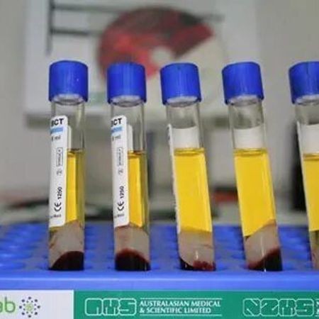 Плазмотерапия Cortexil PRP (1 пробирка)
