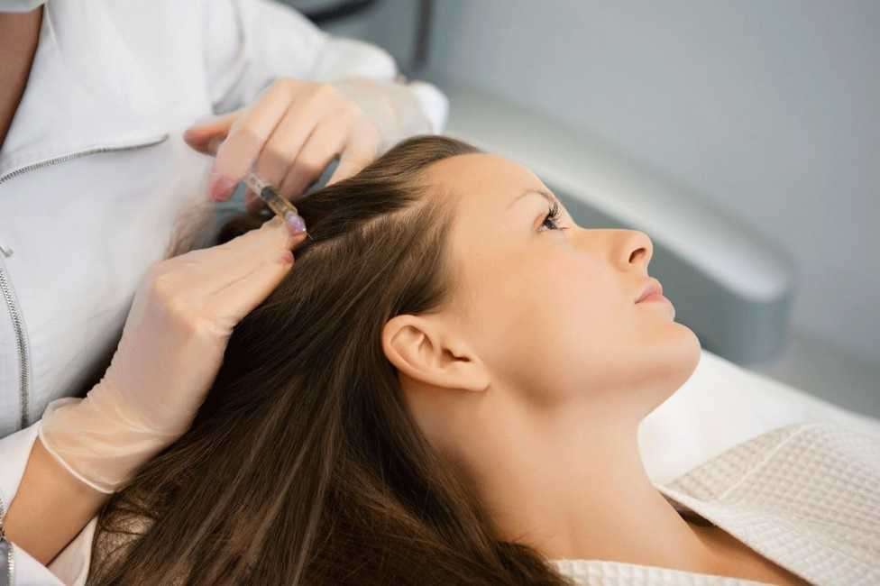 Микроигольчатый РФ - лифтинг волосистая часть головы (без мезококтейля)
