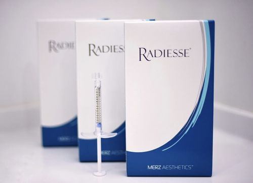 Векторный лифтинг щёк препаратом "Radiesse"
