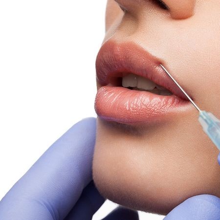 Увеличение губ препаратом Belotero Lips Shape (0,6 мл) или Belotero Lips Contour (0,6 мл) по спеццене Акция НОЯБРЯ!