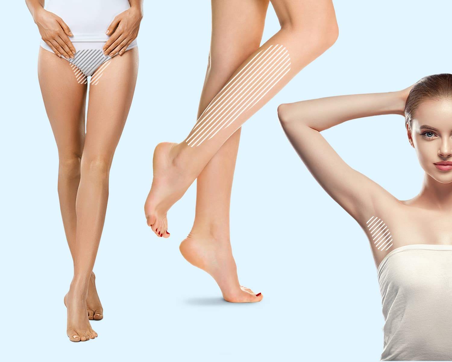 Лазерная эпиляция: ноги полностью + классическое бикини + подмышки 