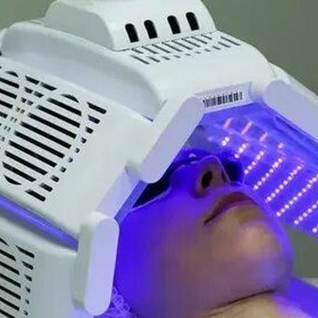 Фотодинамическая терапия (клеточное омоложение)