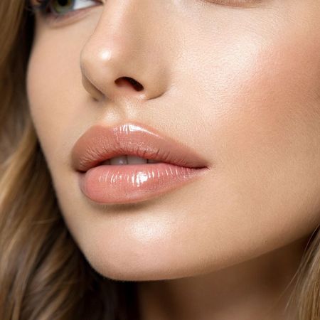 Увеличение губ препаратом Belotero Lips Shape (0,6 мл)