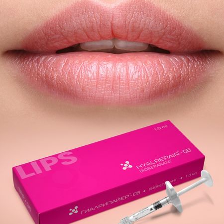 Биоревитализация препаратом Hyalrepair Lips (1 мл): губы