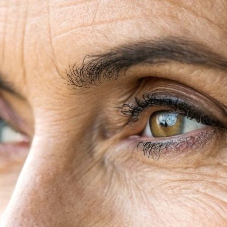 Биоревитализация препаратом Revi Eye (1 мл): зона вокруг глаз