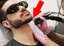 Лазерная эпиляция для мужчин коррекция контуров бороды