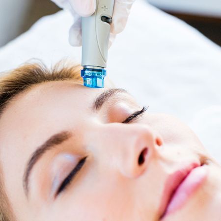 Вакуумная чистка HydraFacial (очищение, базовая)