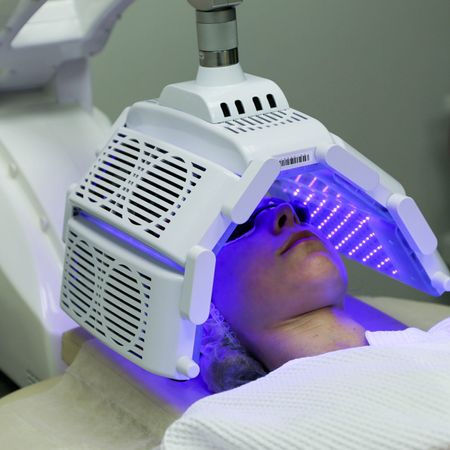 Фотодинамическая терапия (омоложение лица)