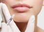Увеличение губ препаратом Belotero Lips Shape 0,6 мл