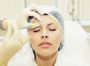 Коррекция мимических морщин препаратом Botox, зоны: лоб, межбровье, глаза(38ед)