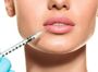 Контурная пластика губ препаратом Belotero Lips Shape 0.6 мл