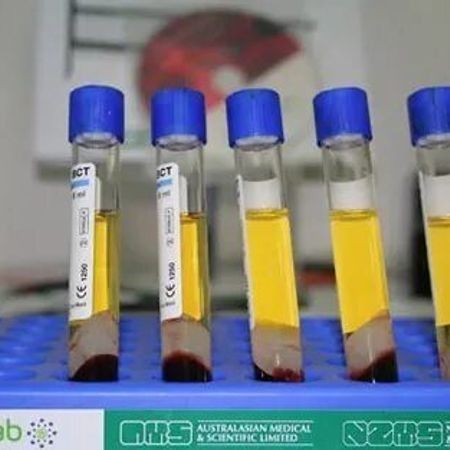 Плазмотерапия Cortexil PRP (1 пробирка)