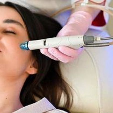 Вакуумная чистка HydraFacial