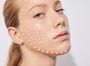 Омоложение кожи лица препаратом Novacutan Ybio/Novacutan SBio, 2 мл