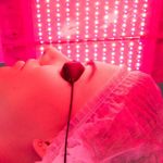 Фотодинамическая терапия Revixan