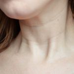 Инъекции Ботокса в шею