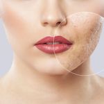 Удаление шрамов и рубцов на лице